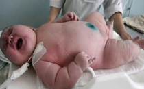 18 Kilo Doğan Bebek Doktorları Şok Etti!