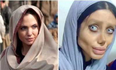 Herkesi Kandırmış! Angelina Jolie'ye Benzemek İsterken Tanınmaz Hale Gelen Kadın Meğer…