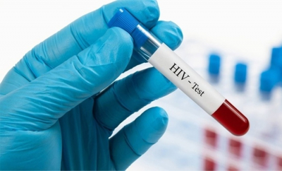 İtalya’da 30’dan Fazla Kadına HIV Virüsü Bulaştıran Adam Tutuklandı