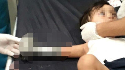 Kurban Bayramı Faciaya Dönüştü! İki İlde İki Minik Çocuk, Ellerini Kıyma Makinesine Kaptırdı