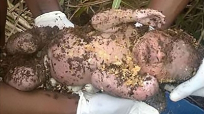 Vicdansız Annenin Diri Diri Toprağa Gömdüğü Bebek 3 Gün Sonra Toprak Altından Bakın Nasıl Çıkarıldı?
